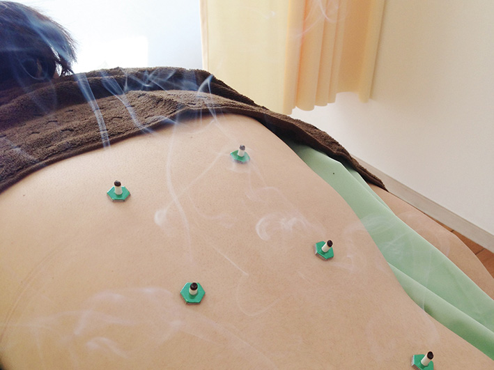 灸各種（自由診療）